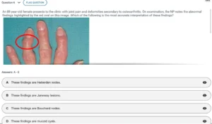 NR509 Week 8: Final Exam